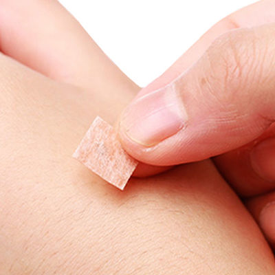 Agujas de acupuntura con punta afilada de acero inoxidable para un rendimiento preciso